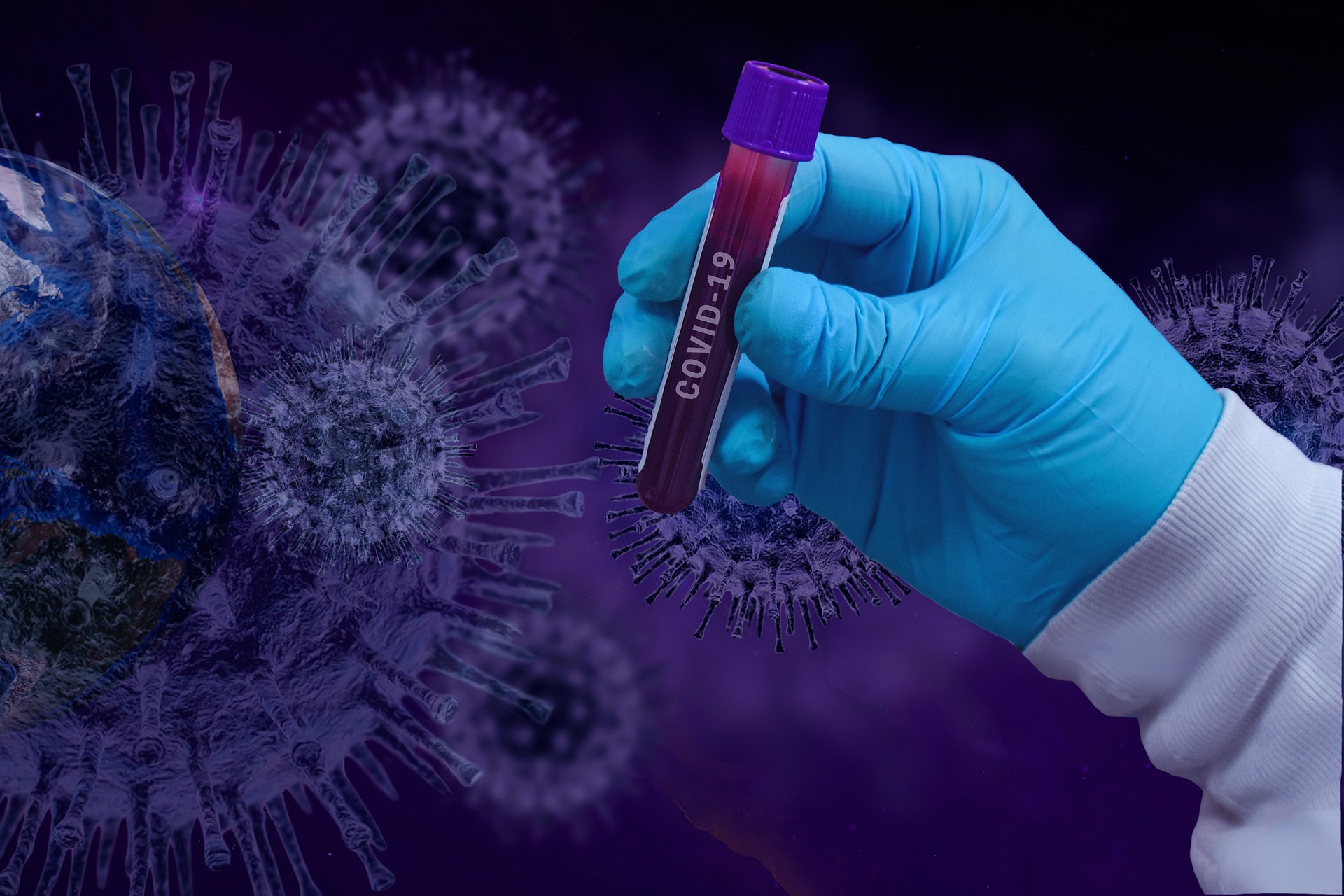 Abbott, BD join chorus of COVID-19 test makers claiming diagnostics not impacted by omicron variant