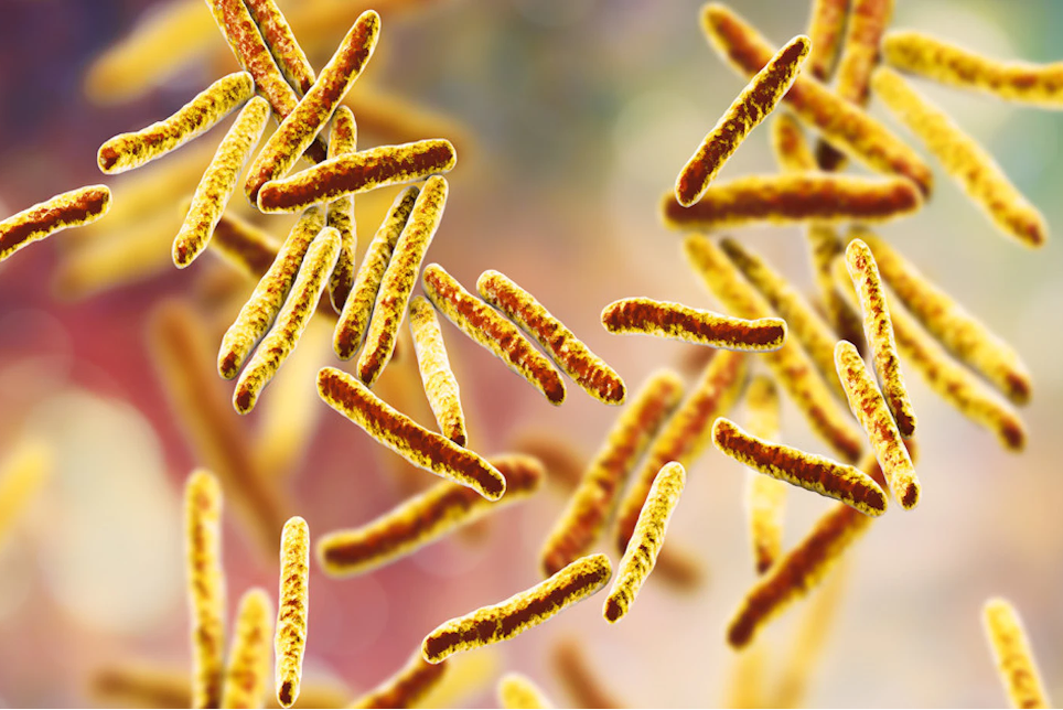 Lab-on-a-chip tech enables fast, cheap tuberculosis detection in study