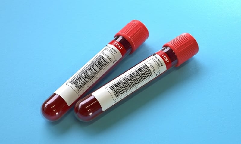  C2N Diagnostics launches revamped Alzheimers blood test
