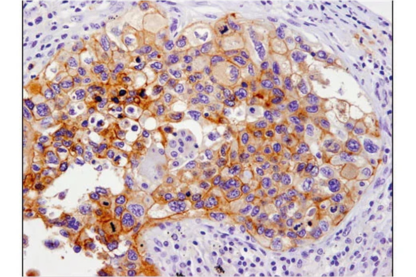 AmoyDx and CST Expand Existing Partnership for the Development of Companion Diagnostics (CDx) to Support Precision Oncology