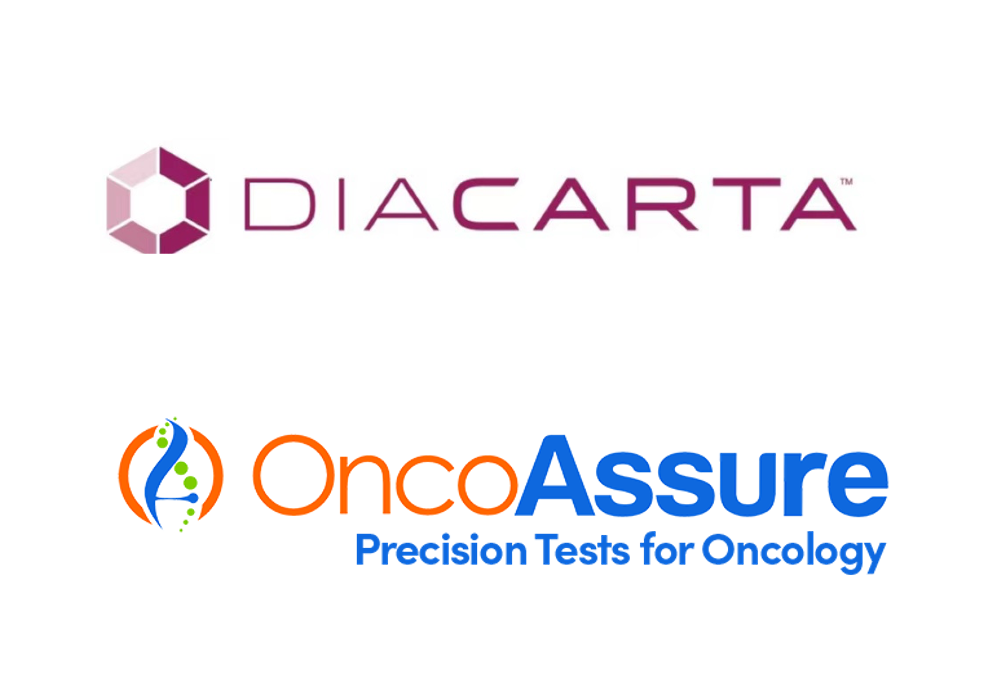 DiaCarta, Inc. and OncoAssure Ltd. Collaborate to Launch Prostate Cancer Lab Developed Test