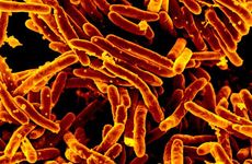 WHO Publishes New Guidance Recommending Targeted NGS for Drug-Resistant TB Diagnosis