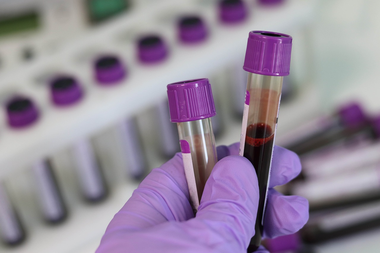 World Ovarian Cancer Day | Chinas Ovarian Cancer Diagnostics Market