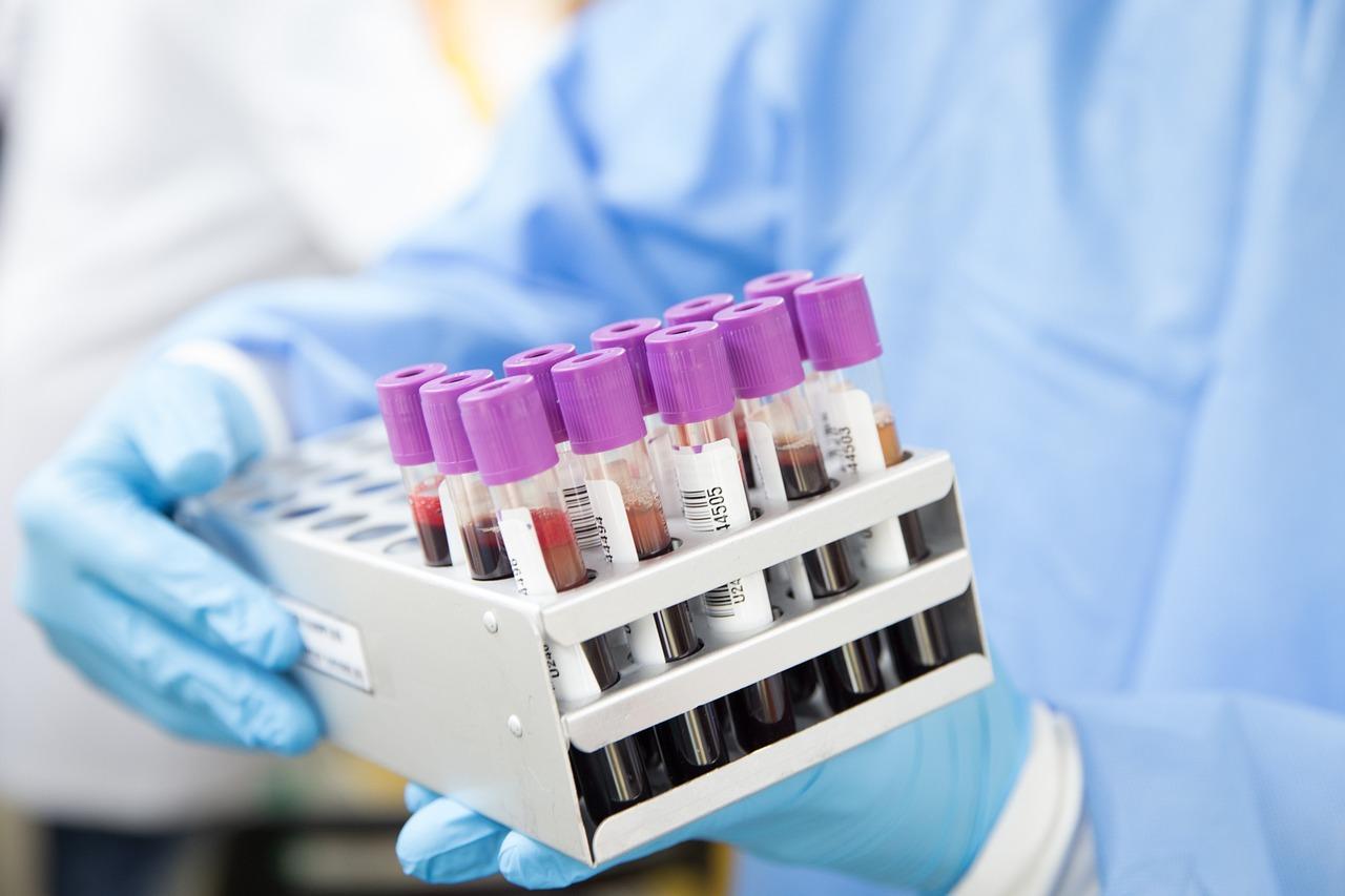 In Vitro Diagnostic Industry in China - Blood Typing Instruments and Reagents VIII