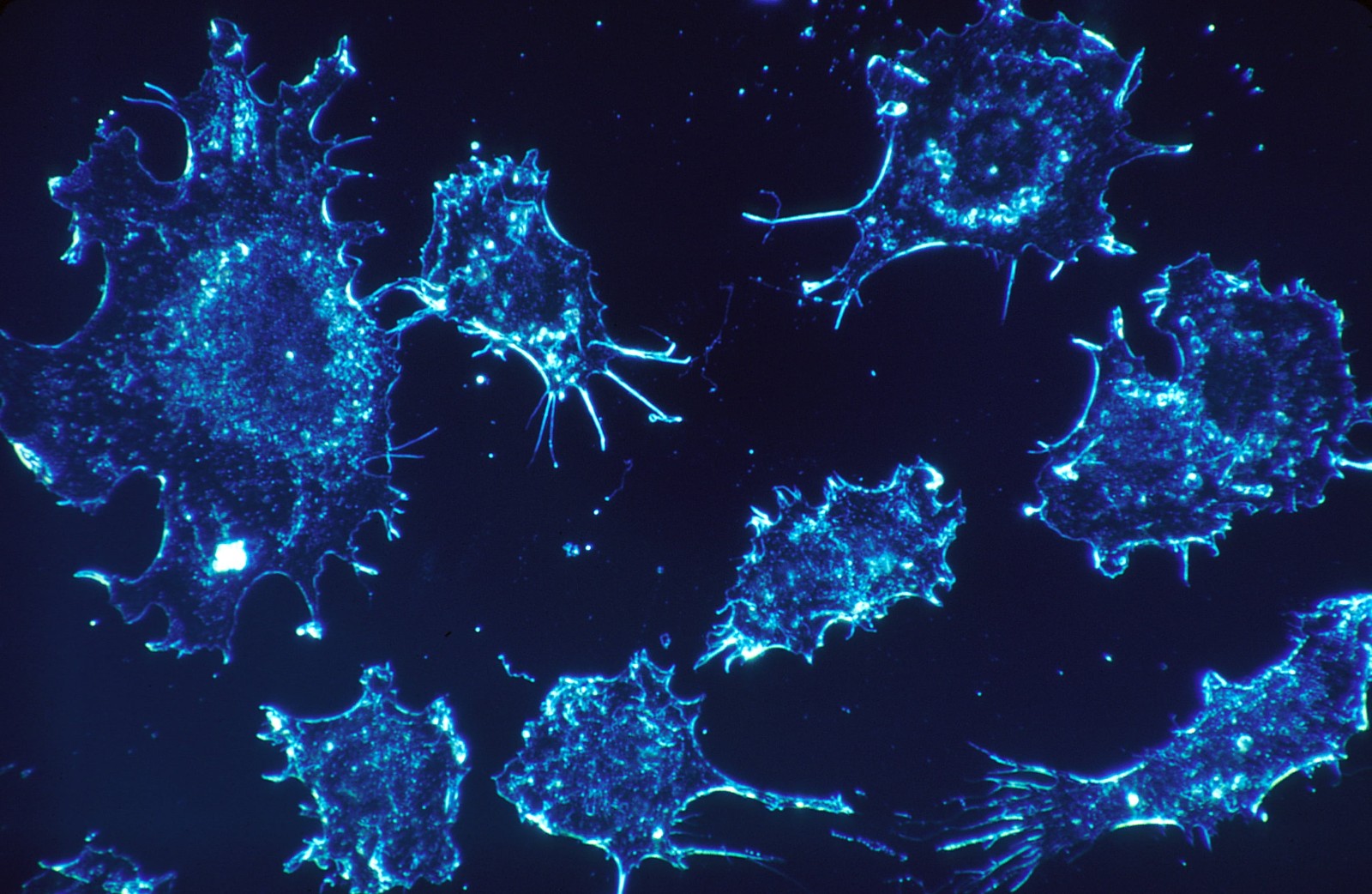 SARS-CoV-2 Immunity Rapidly Declines Within Months of Infection