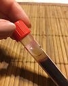 Grail Sets Fast Pace in Liquid Biopsy with New Milestones
