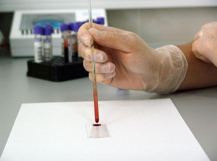 GRAILs SUMMIT Will Help Define its Liquid Biopsy Path