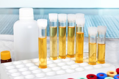 New Study Helps To Improve Detection of Disease in Newborn Babies