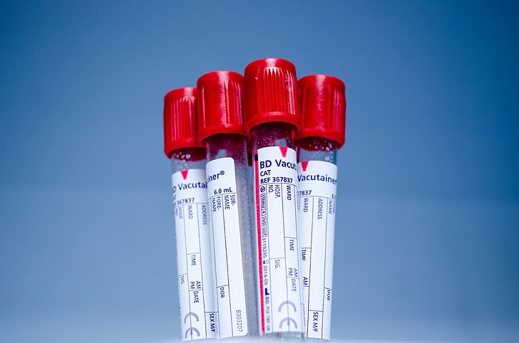 Host Factors Influence COVID-19 Severity More Than Viral Genetic Variation, Study Finds