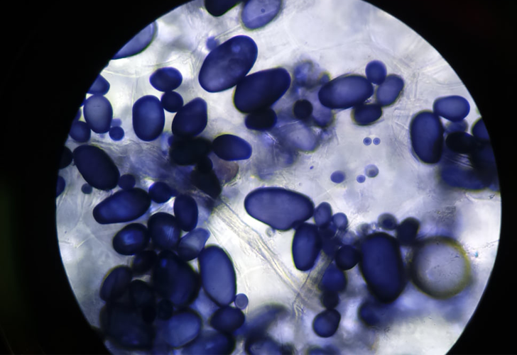 Microbiome-based Diagnostic Tool Can Detect Liver Fibrosis and Cirrhosis in Stool Samples