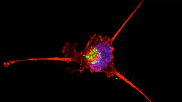 Blood-based Biomarkers Can Help To Predict Recurrence of Triple Negative Breast Cancer