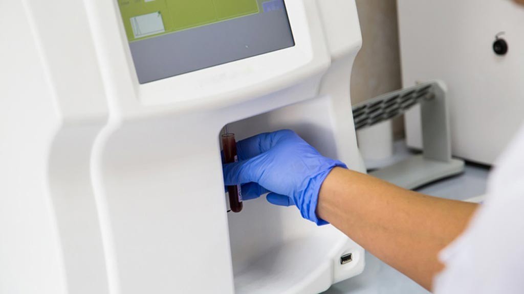 Global Blood Gas Analyzers Market to Surpass USD 940 Million by 2026 