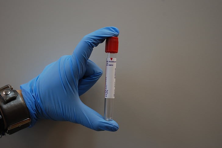 14 Chinese IVD Enterprise Successfully Developed B.1.1.7 Testing Kits